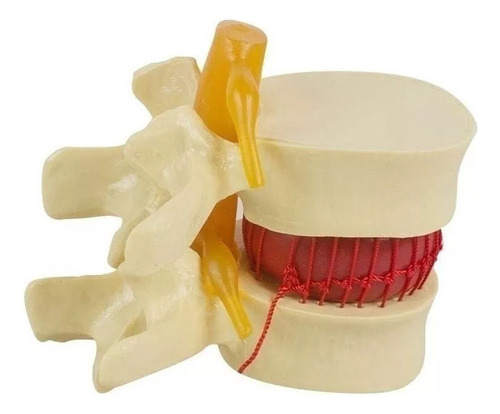 Anatomía Disco Lumbar Columna Vertebral Modelo Enseñando2024