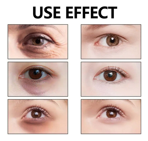 T 50g E Creme Para Os Olhos Para O Canto Interno Do Olho - H