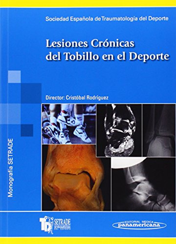 Libro Lesiones Crónicas Del Tobillo En El Deporte De Socieda