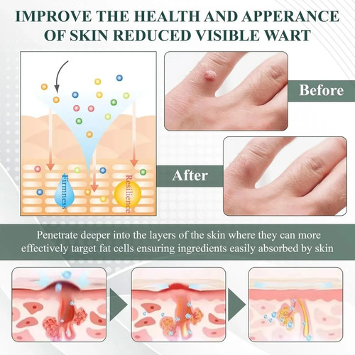 Gel Eliminador Instantáneo De Lunares Y Manchas, Gel Elimina