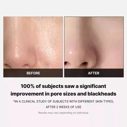 Cojín Tónico Facial Medicube Zero Pore Pads 2.0 For T.