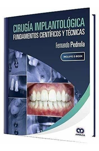 Cirugía Implantológica. Fundamentos Científicos Y Técnicas.