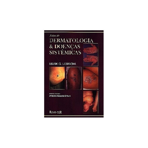 Atlas De Dermatologia E Doenças Sistêmicas