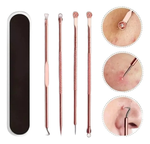 Kit Extractor Removedor Puntos Negros Espinillas Acné 4 Pzas