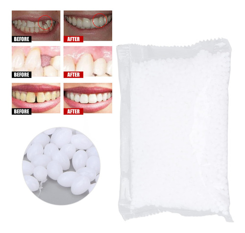 Cuenta De Relleno De Dientes Temporal, Cuenta De Ajuste