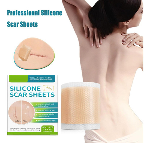 . Láminas De Silicona Profesionales For Cicatrices