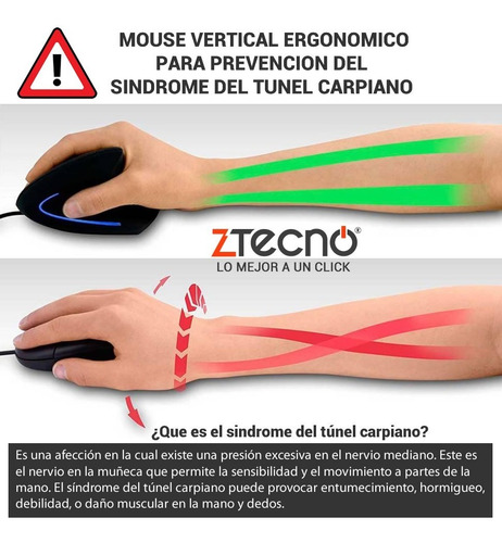 Imagen 9 de 10 de Mouse Vertical Klip Xtreme Krest 6 Bot Ergonómico Usb