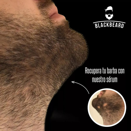 Minoxidil 10% Roll On Blackbeard Con Cafeína 10 Piezas