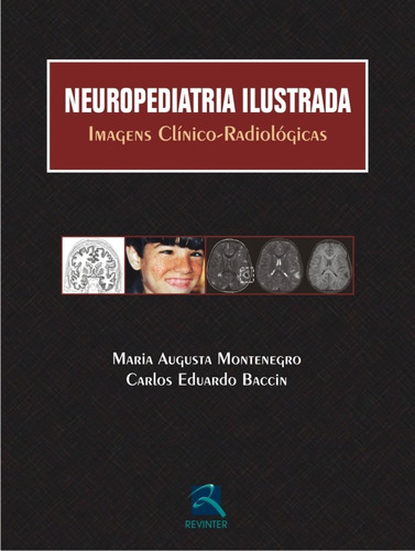 Neuropediatria Ilustrada: Imagens Clínico-Radiológicas, de Montenegro, Maria Augusta. Editora Thieme Revinter Publicações Ltda, capa dura em português, 2015