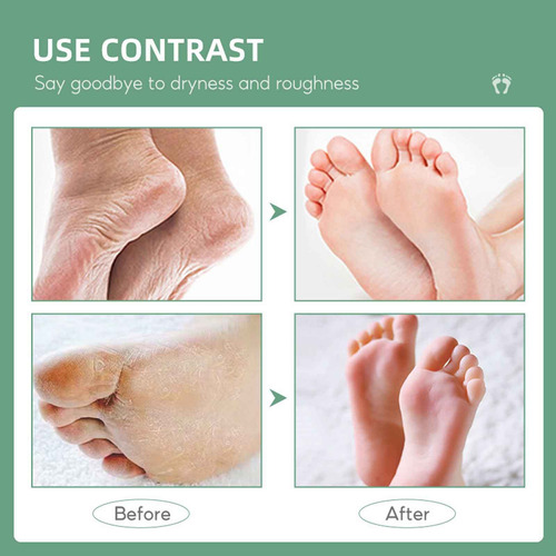 Y Urea Cream 40% | 2% Salicylicacid | Intensive Urea Foot Cr