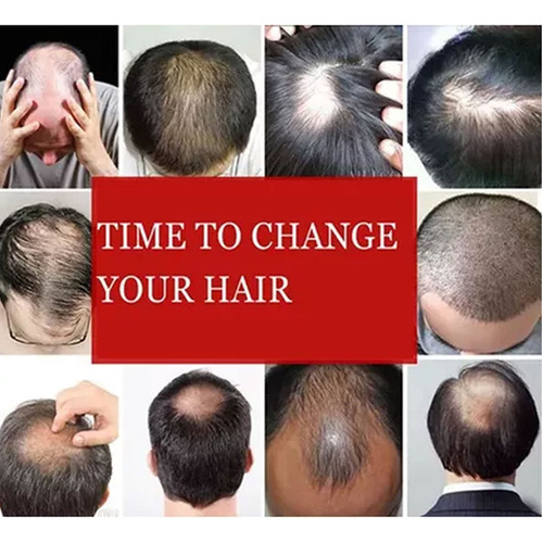 Conjunto De Pelucas De Los Hombres Con El Pelo Corto