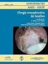 Cirugia Reconstructiva Del Hombro (monografias Aaos Secot)