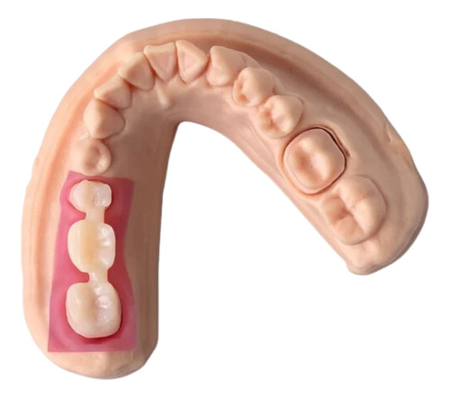 1 Kg Resina Para Impresora 3d Esun Gingiva Modelos Dentales