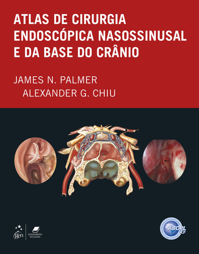 Atlas De Cirurgia Endoscópica Nasossinusal E Da Base Do Crân