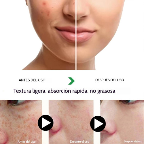 Gb Nueva Crema Blanqueadora Y Antipecas Fuyan