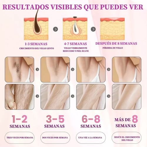 Depiladora Láser Definitiva Cuerpo 5 Niveles Ipl Removedor Blanco