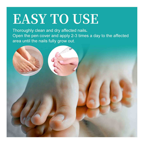 Para Melhorar As Unhas Dos Pés, Unhas E Pés Infectados 3ml