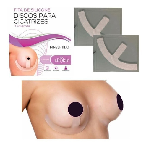 Fitas De Silicone De Cicatriz 50cm Mama T Invertido E Aréola Sem