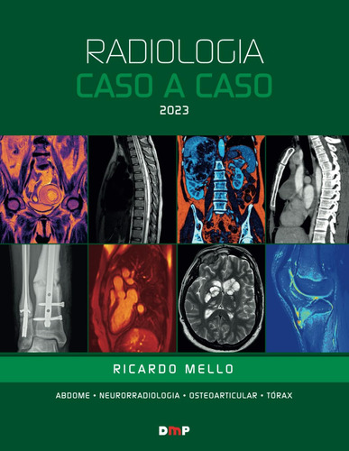 Radiologia Caso A Caso 2023