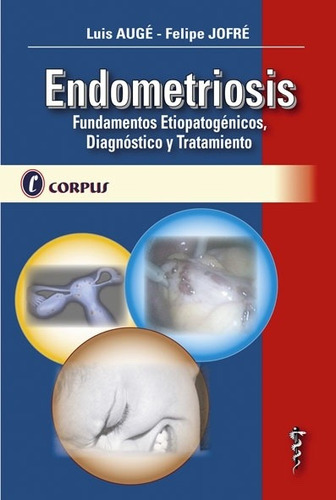 Endometriosis  Augé - Jofré  Ed. Corpus  Nuevo.