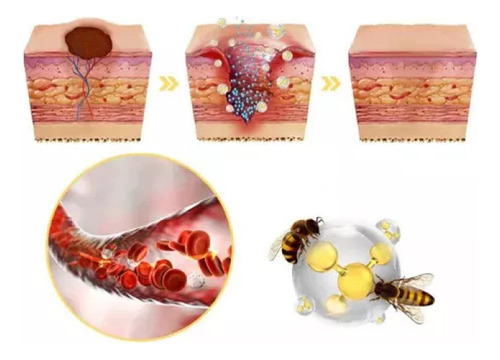 17- A 3pcs Tag Recede Bee,tag Recede Bee Spray For Mujeres Y