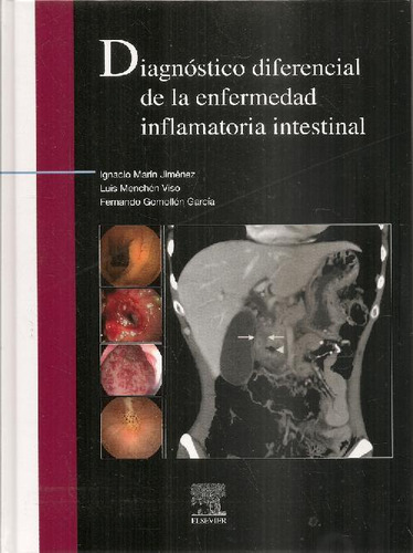 Libro Diagnóstico Diferencial De La Enfermedad Inflamatoria