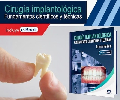 Ciruga Implantolgica Fundamentos Cientficos Y T,jk