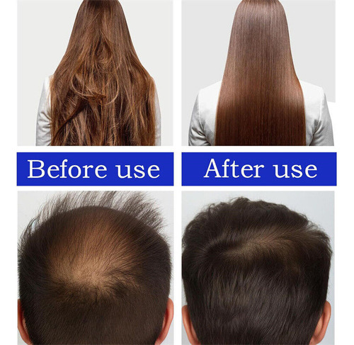 , Aceite For El Crecimiento Del Cabello, 3 Unidades, 60 Ml A
