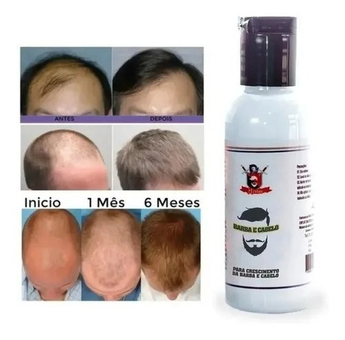 Kit X 2 Unidades Producto Para Crecer Cabello - Barba 