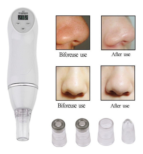 Microdermoabrasion Microdermabrasion Vacum Rejuvenecimiento