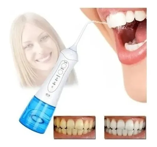 Irrigador bucal portatil new arrivals
