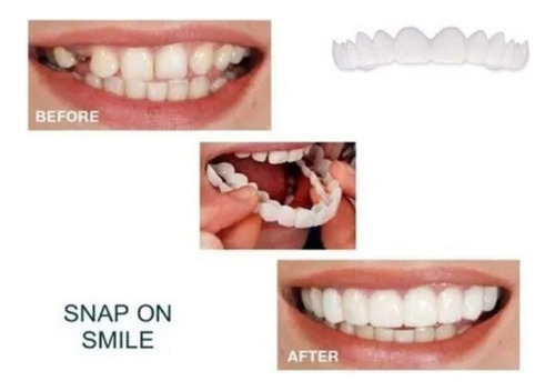 Soporte Provisional Para Una Dentadura Postiza