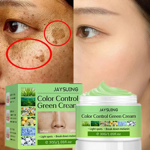 Crema De Melasma Para Eliminar Manchas Oscuras Y Blanquear P