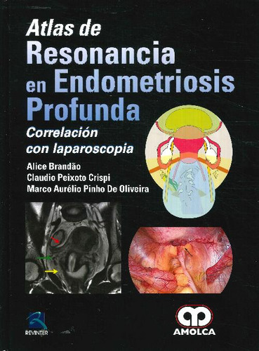 Libro Atlas De Resonancia En Endometriosis Profunda De Claud