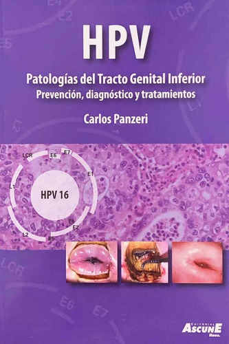 Hpv Patologías Del Tracto Genital Inferior Carlos Panzeri 