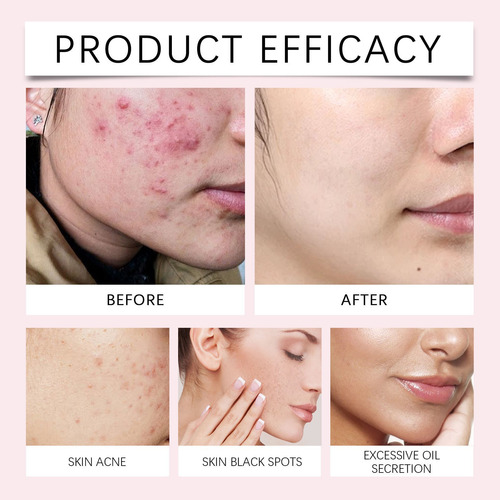 Una Almohadilla Limpiadora Facial Con Ácido De Cúrcuma Ilumi