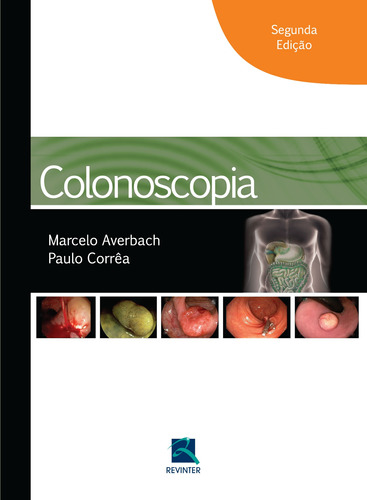 Colonoscopia, de Averbach, Marcelo. Editora Thieme Revinter Publicações Ltda, capa dura em português, 2015