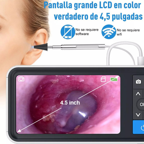 Otoscopio Digital 600w Píxel 3.9mm Hd Oído Alcance Endoscopi