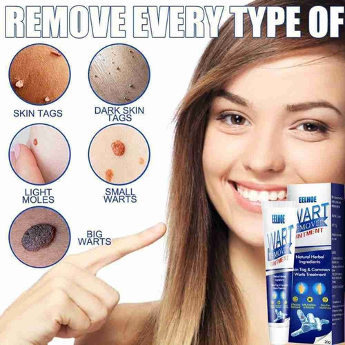 2* Pomada Cremosa Anti-verrugas, Creme Anti-sardas, Removedo