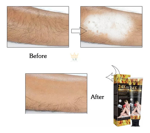 Crema Depilatoria Disaar 24k Gold Y Colageno 100ml