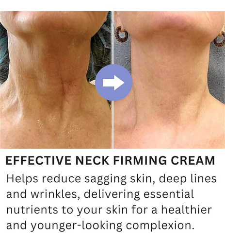 Galucky Crema Reafirmante De Cuello, Crema Antiedad Para