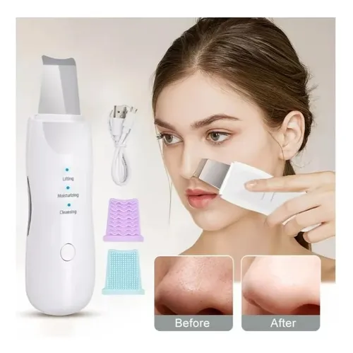 Espátula Peeling Facial Ultrasónico Exfoliante Limpiador Usb
