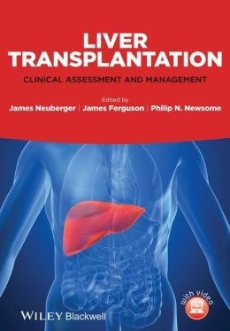 Liver Transplantation: Clinical Assessment And Management -