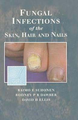 Fungal Infections Of The Skin And Nails - Raimo E. Suhone...