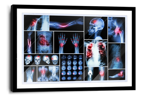 Marco De Poliuretano Con Poster Radiografia Cuerpo 45x70cm