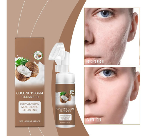 Un Limpiador Facial En Espuma De Coco De 100 Ml Que Limpia S