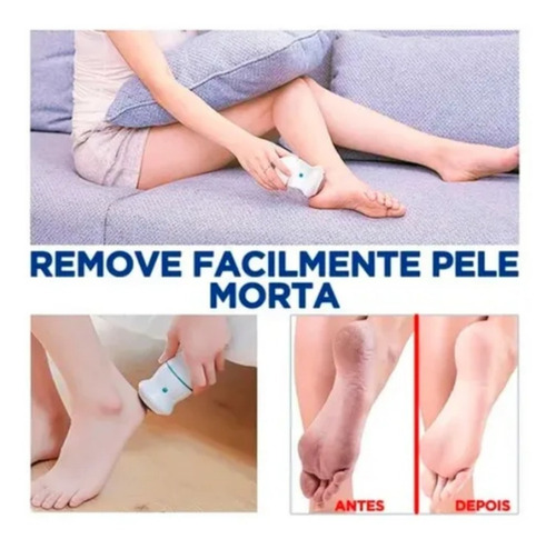 Imagem 5 de 9 de Lixa Elétrica De Pés Esfoliador Calos Elétrico Para Pés Usb