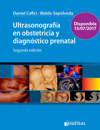 Ultrasonografia En Obstetricia Diagnostico Prenatal 2/ed - C