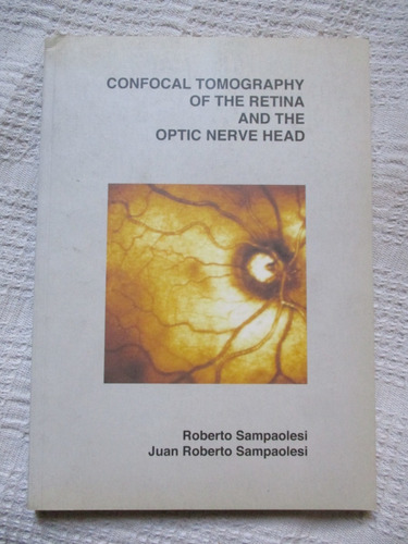 Sampaolesi - Confocal Tomography Of The Retina