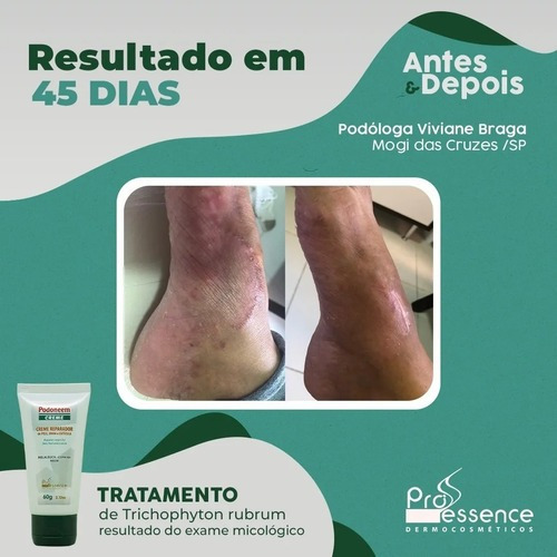 Creme Para Frieira - Com Melaleuca, Copaíba E Neem 60g